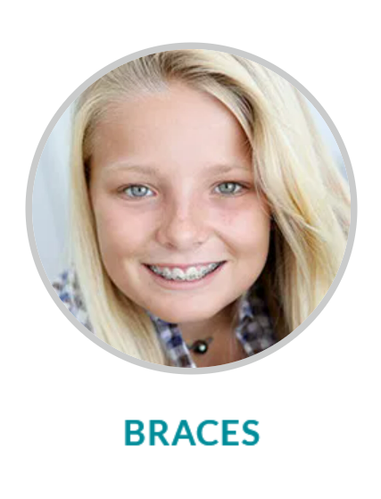 Braces